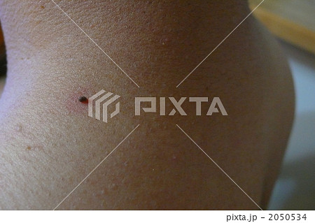 角質粒の写真素材