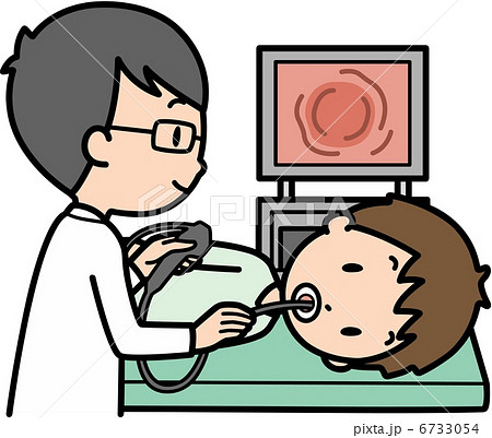 内視鏡検査 胃カメラ 医師 患者のイラスト素材