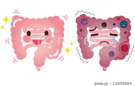 大腸ガンのイラスト素材