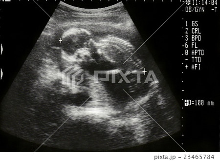 16週 赤ちゃんの写真素材