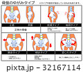 骨盤のゆがみ 分類図4 オレンジ色 説明あり のイラスト素材