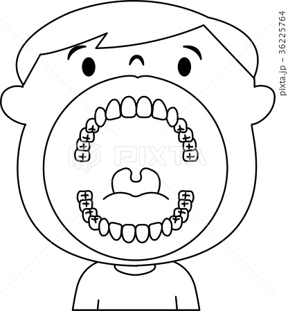 子ども 小学生 歯 口の中のイラスト素材