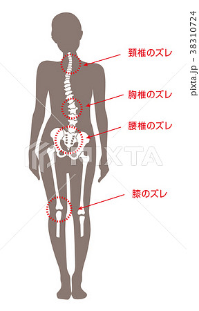 歪みのイラスト素材