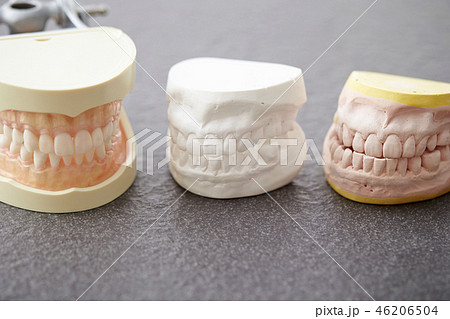 石膏 歯型 模型 歯科の写真素材