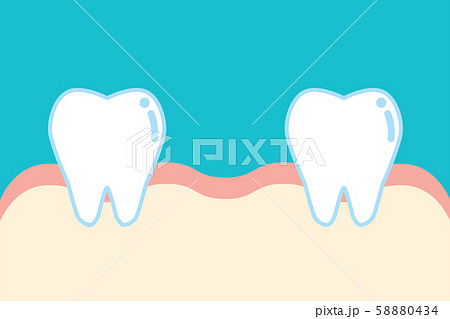 抜歯のイラスト素材