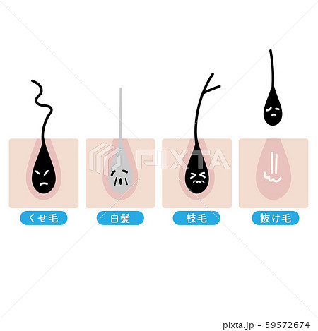 枝毛のイラスト素材