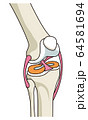 膝関節の構造 イラストのイラスト素材