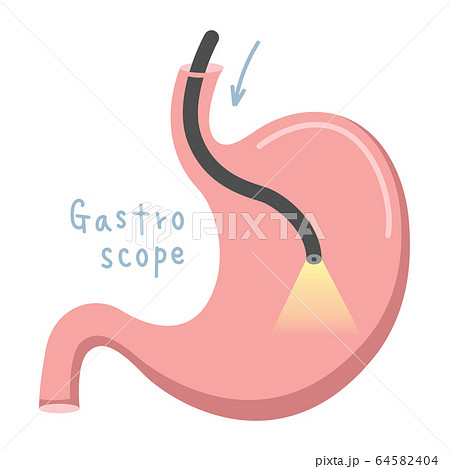 胃カメラのイラスト素材
