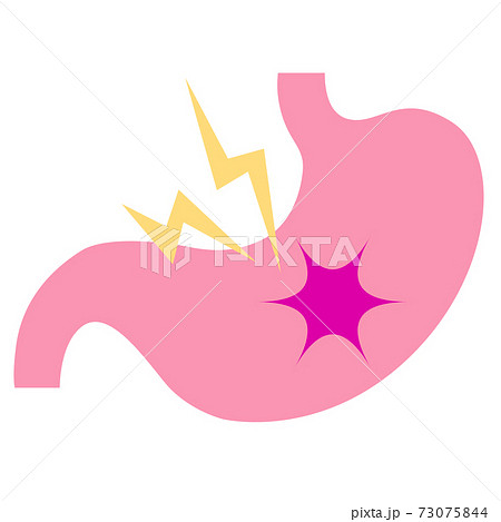 胃下垂のイラスト素材