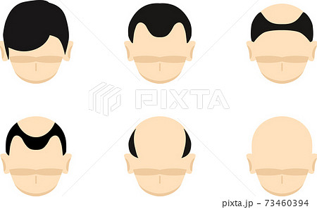 男性 頭部 頭 後頭部のイラスト素材