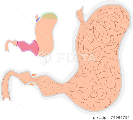 胃のイラスト素材